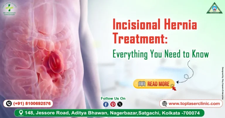 Incisional Hernia Treatment: Everything You Need to Know