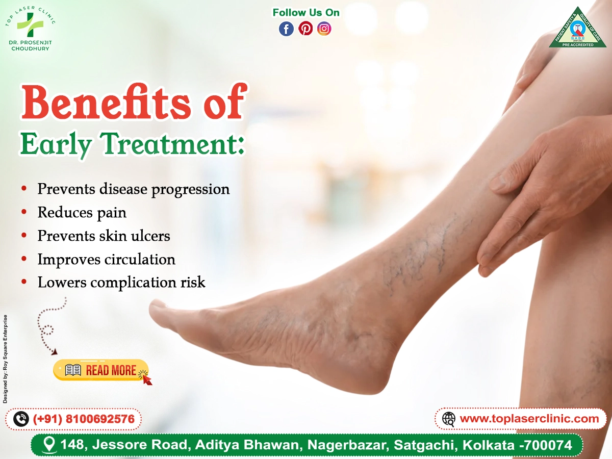 Benefits of Laser Varicose Vein Treatment