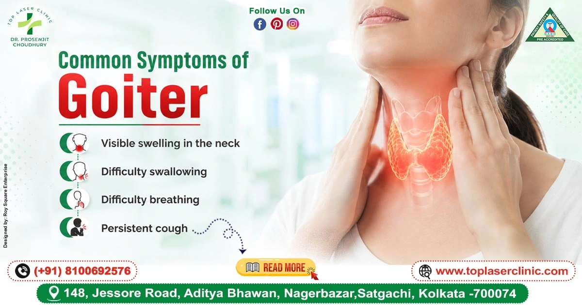 Common Symptoms of Goiter