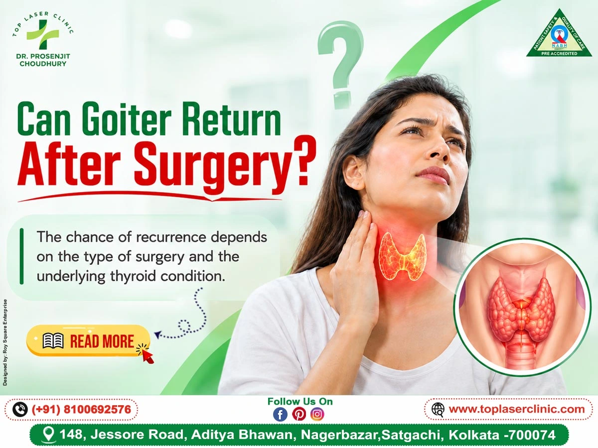 Can Goiter Return After Surgery?