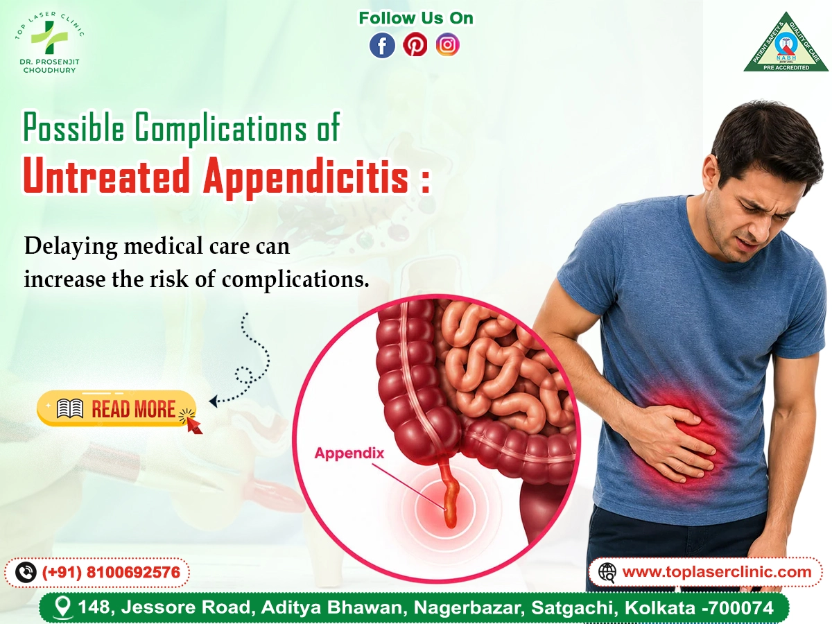Possible Complications of Untreated Appendicitis