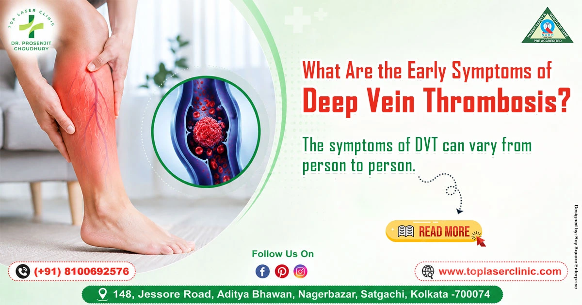 What Are the Early Symptoms of Deep Vein Thrombosis?