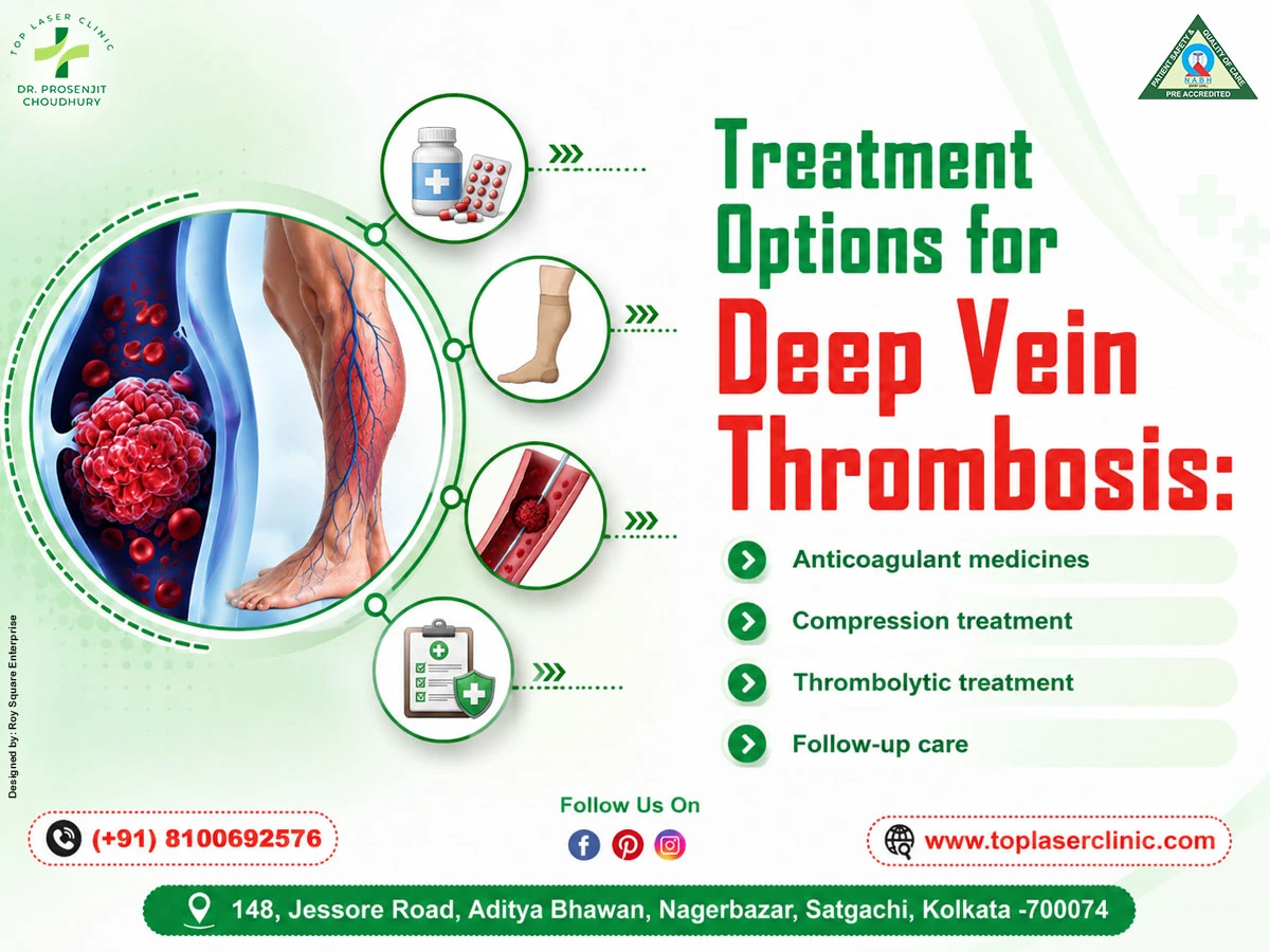 Treatment Options for Deep Vein Thrombosis