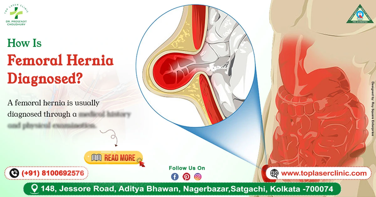 How Is Femoral Hernia Diagnosed?